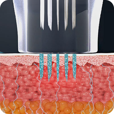 Potenza_Invasive_03