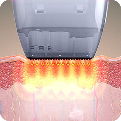 Potenza_Non-Invasive_01