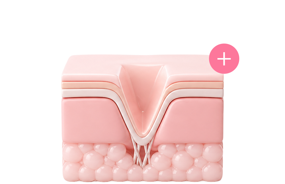 acne_image_06