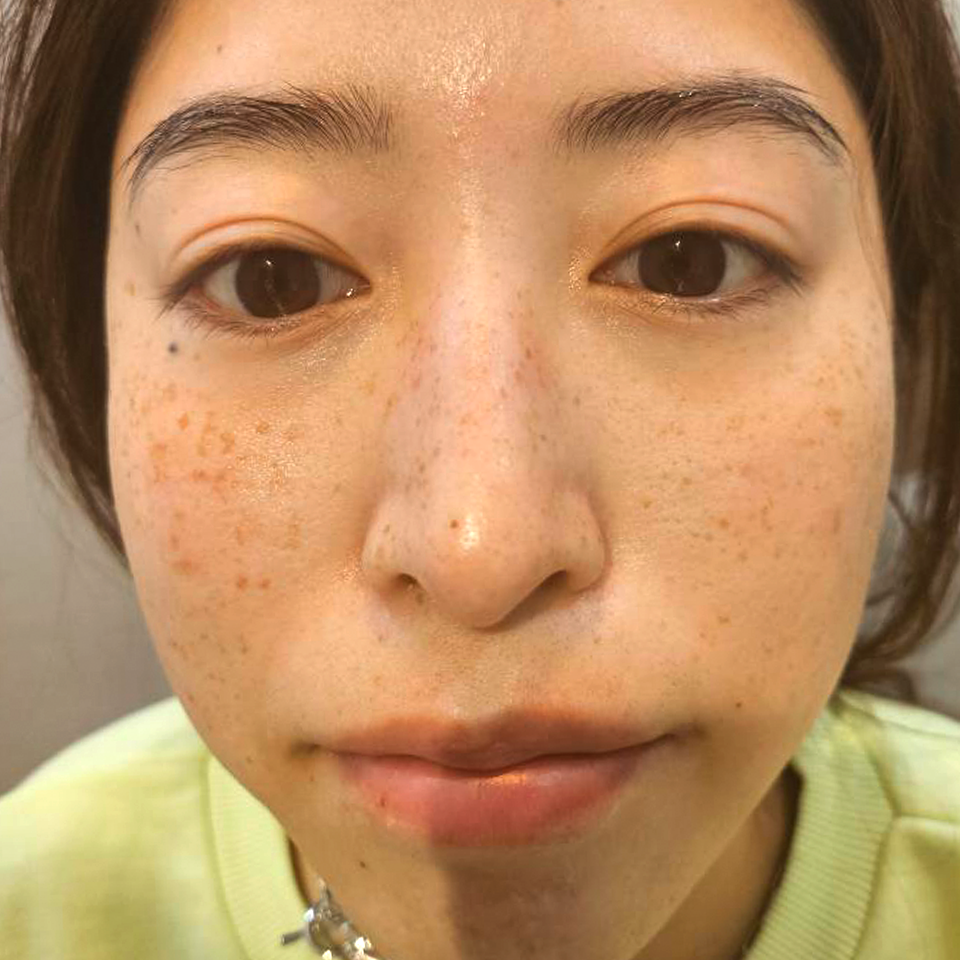 Before