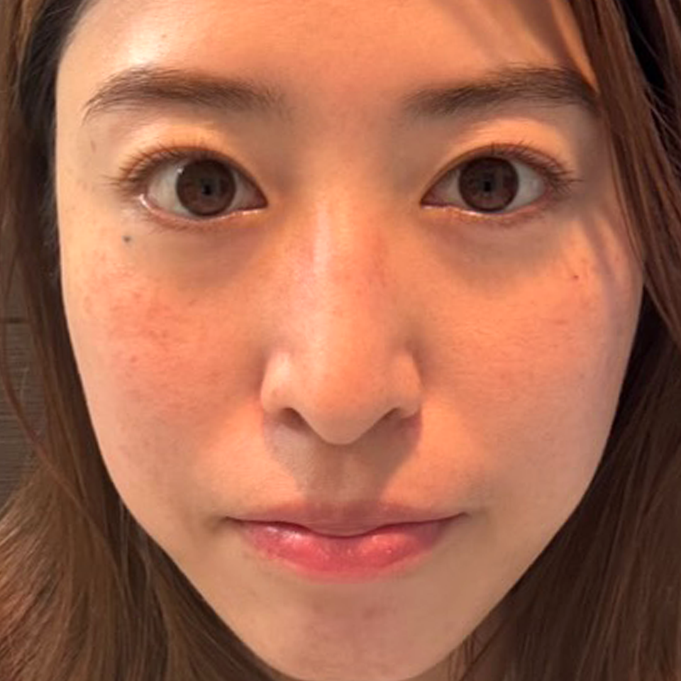 After