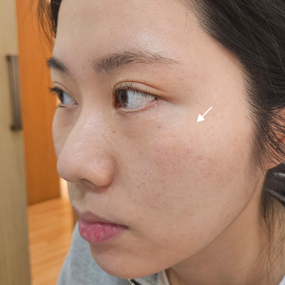 After