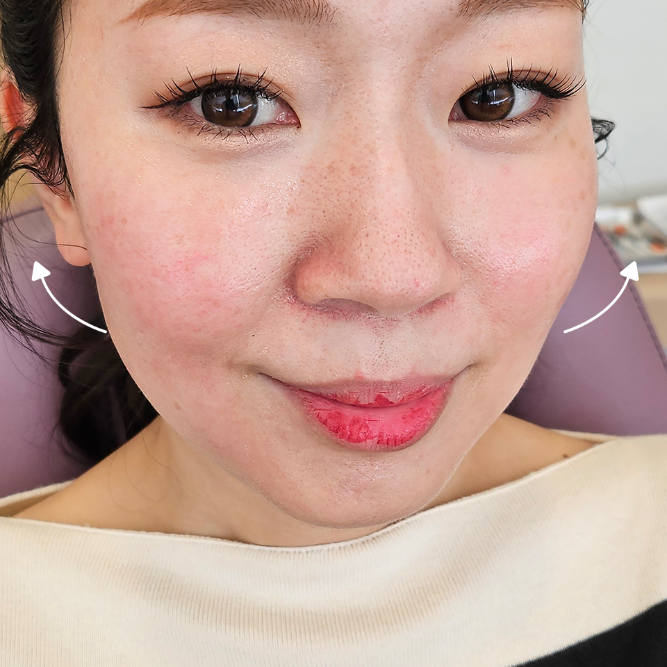 After