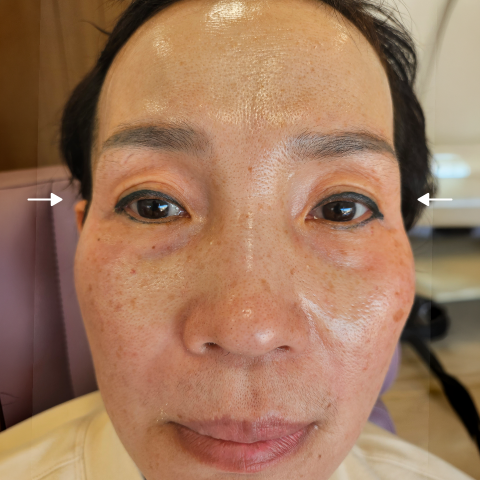 Before