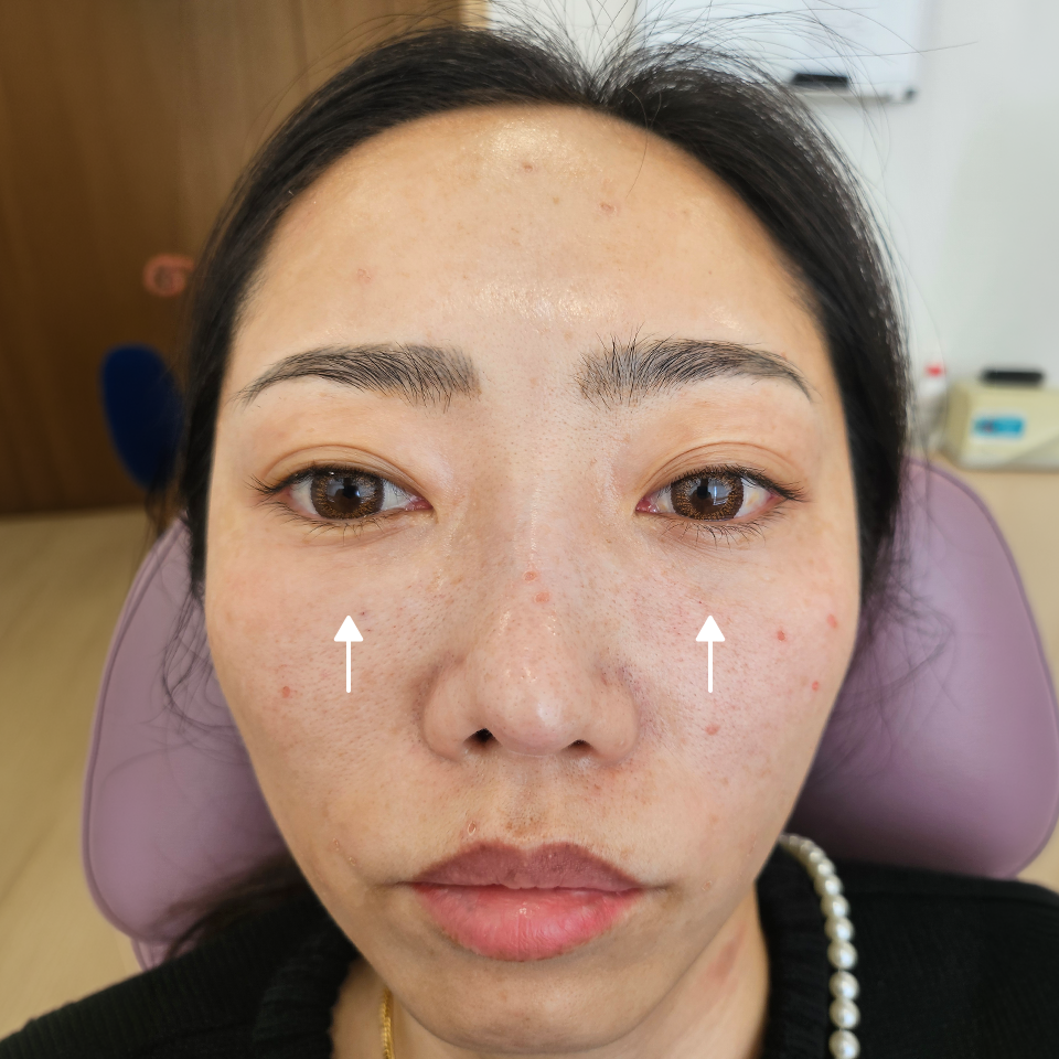 After