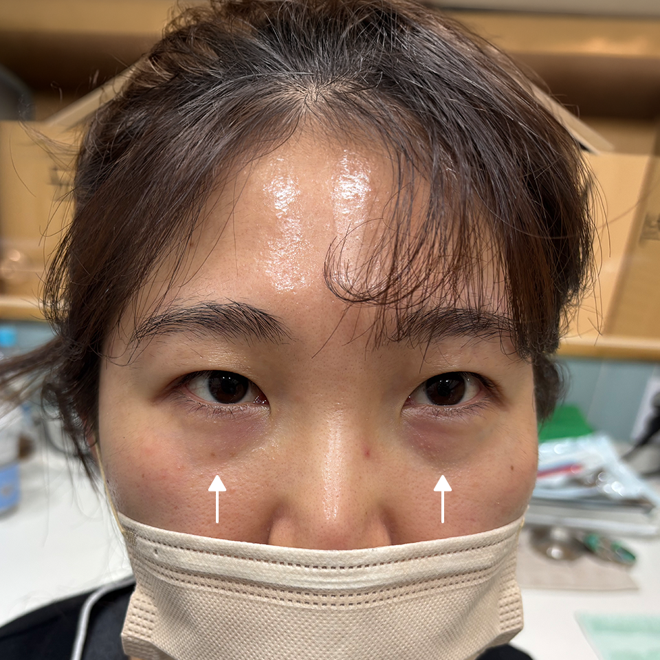 Before