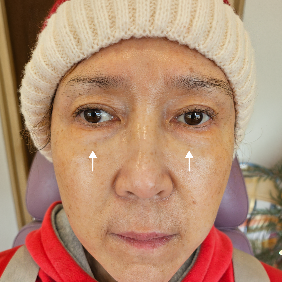 Before