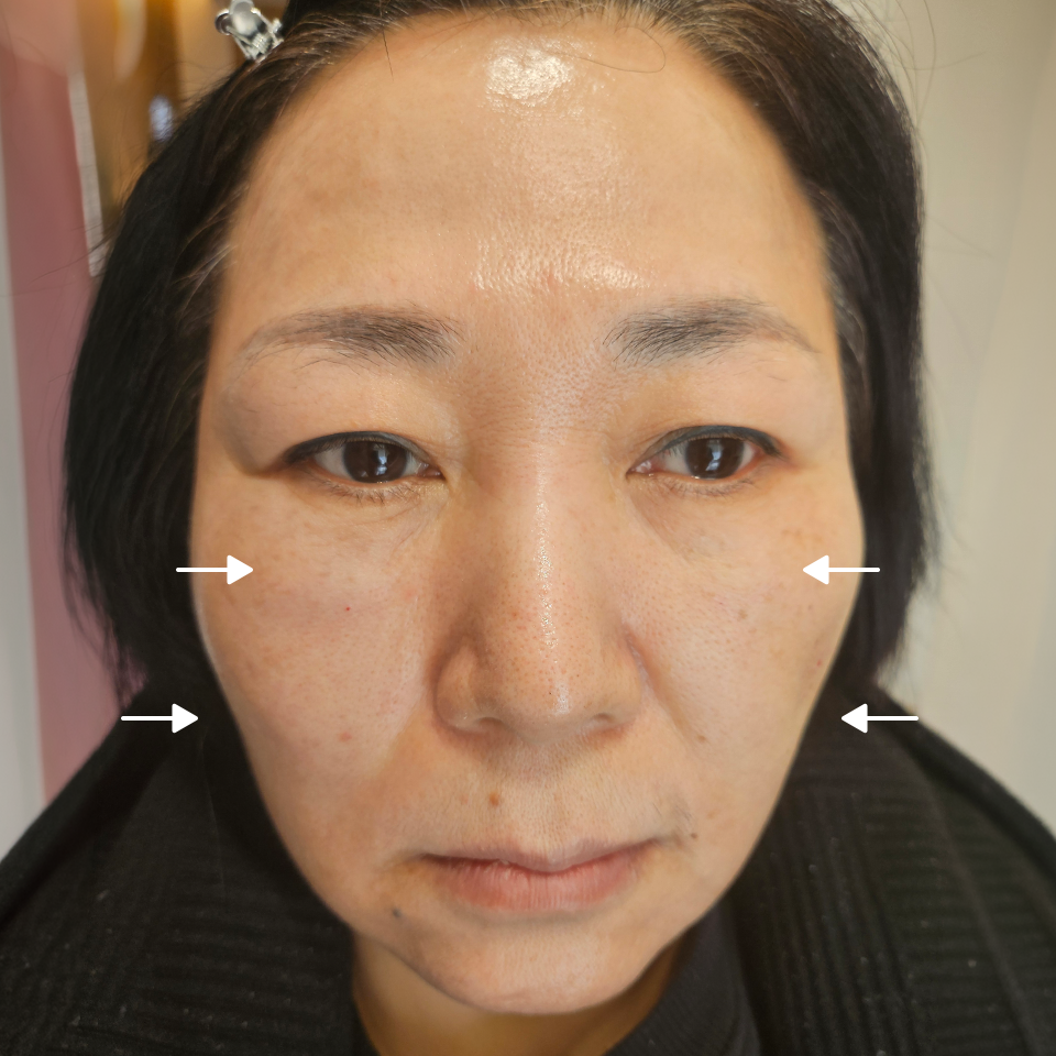 After