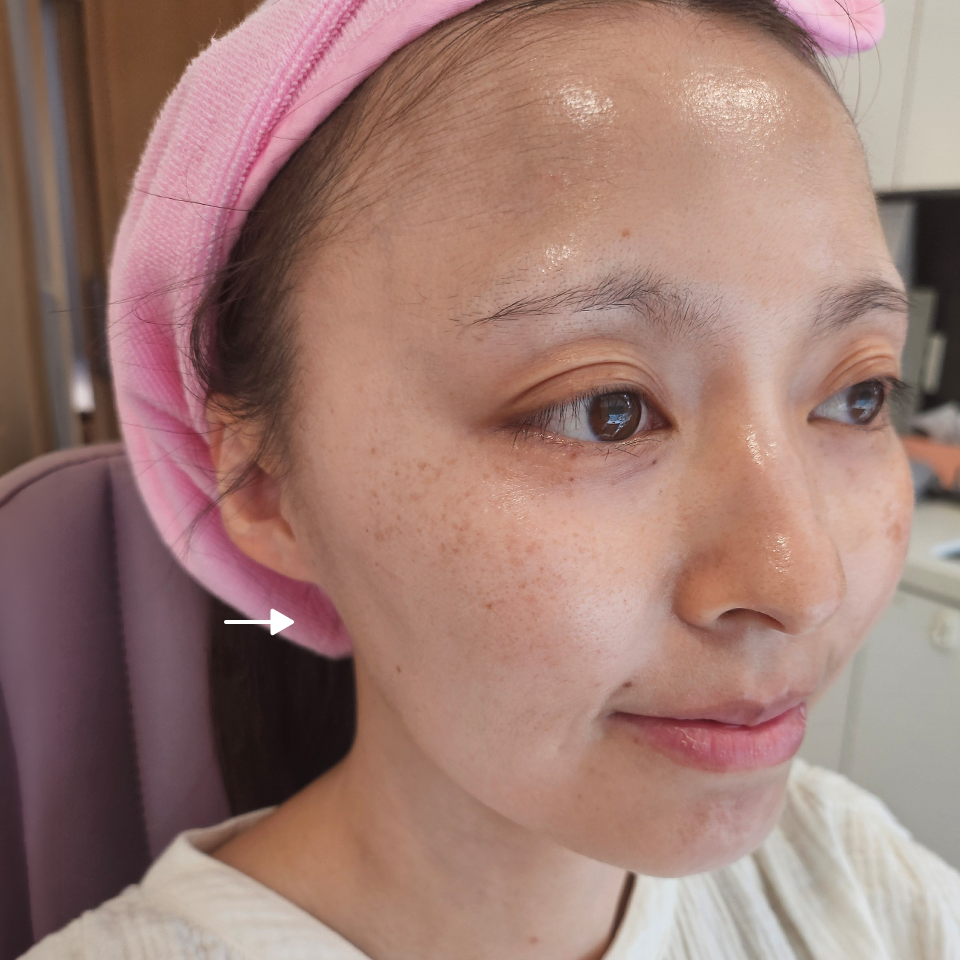 Before