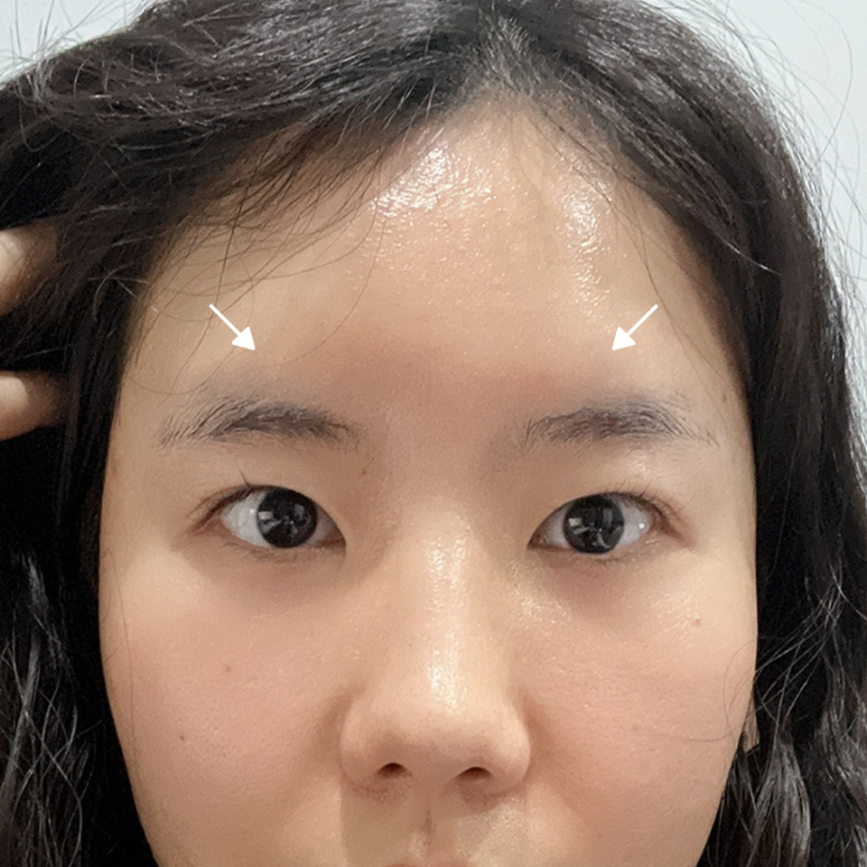 After