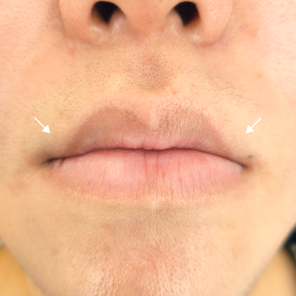 Before