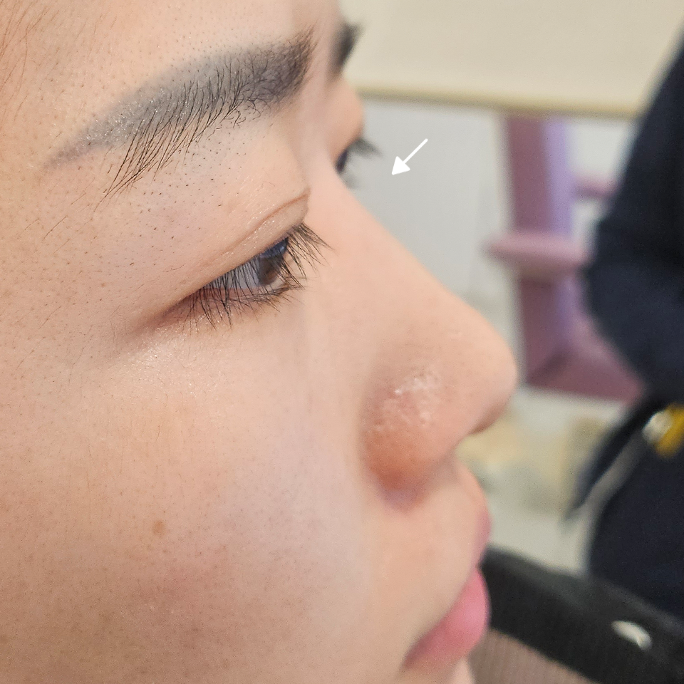 Before