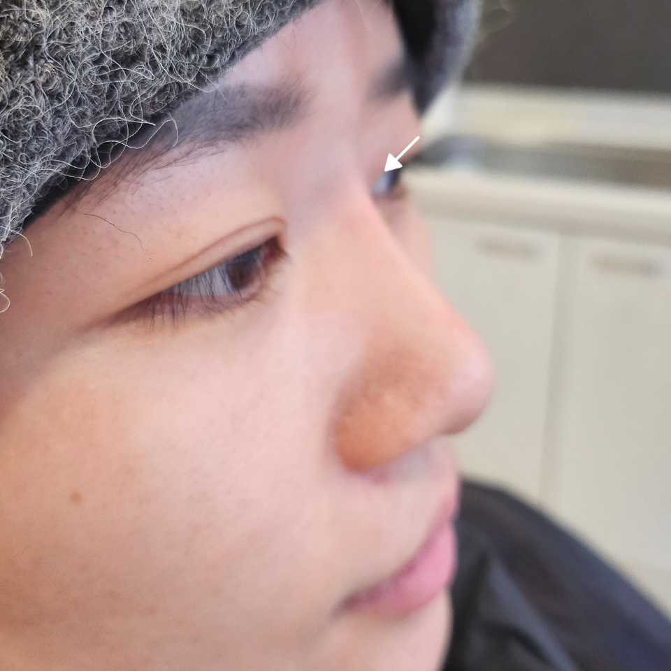 After