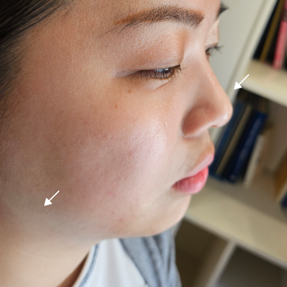 Before