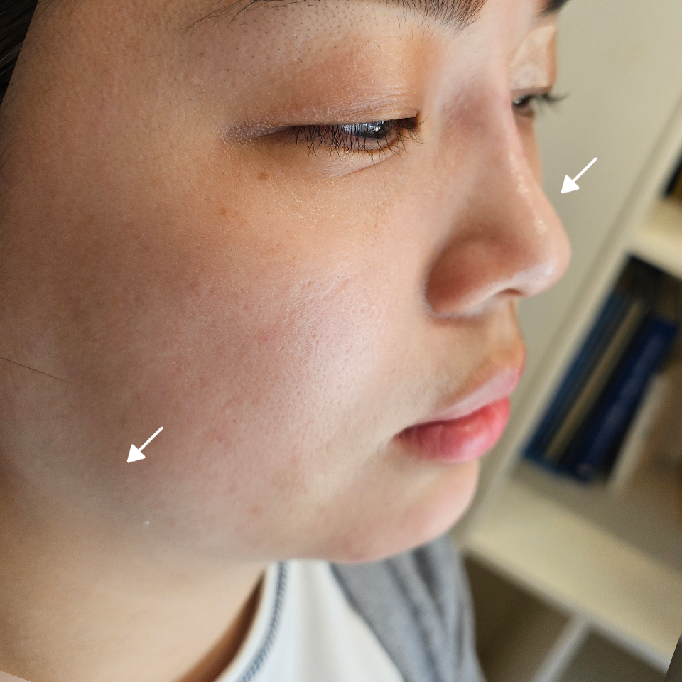 After