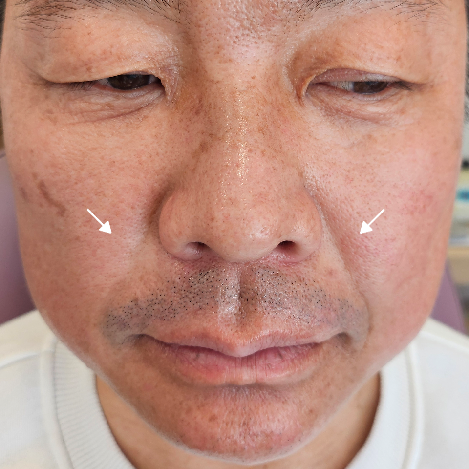 Before