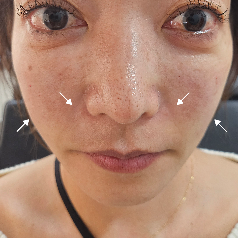 After