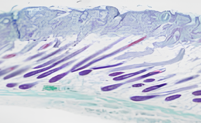 Neuramis_4row_1