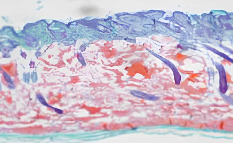 Neuramis_4row_2