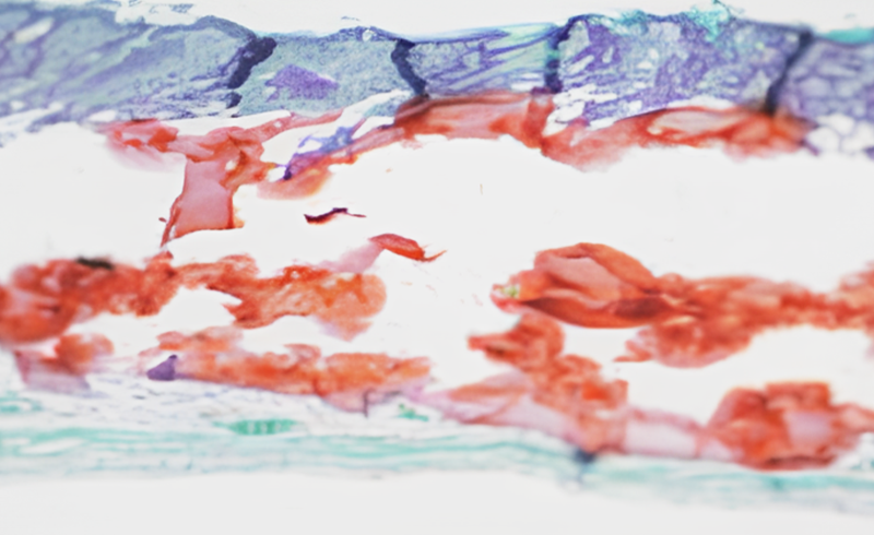 Neuramis_4row_3