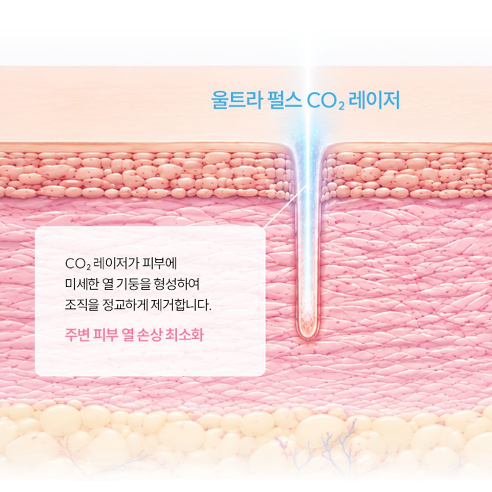 bg_0520_03_mo1