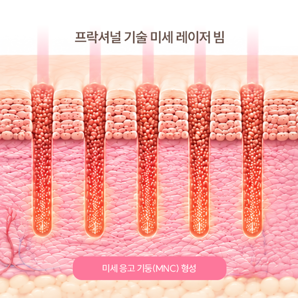 bg_0520_04_mo01