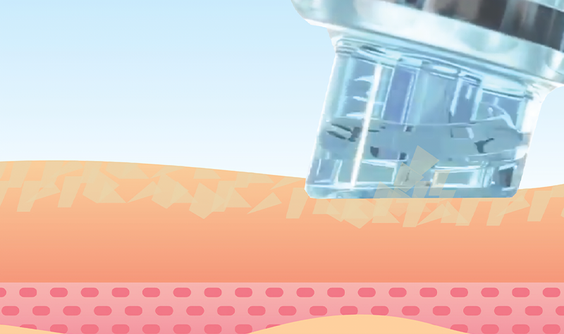 rejubrry-hydrafacial-4row1