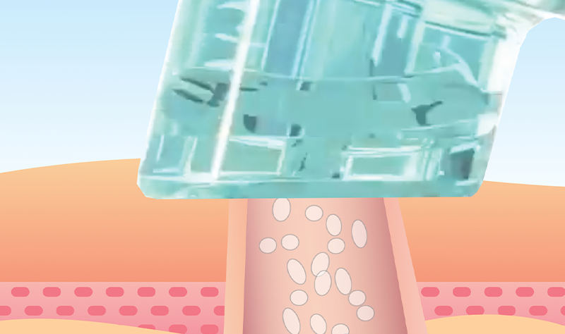 rejubrry-hydrafacial-4row2
