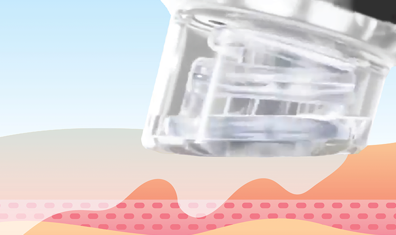 rejubrry-hydrafacial-4row3