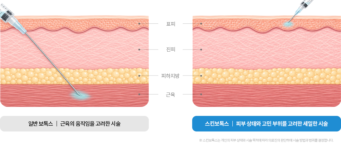 rejubrry-skinbotox-2row-img-1