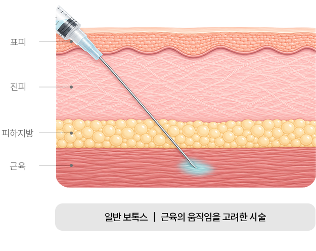 rejubrry-skinbotox-2row-img-m1