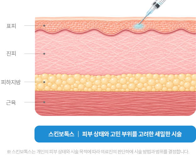 rejubrry-skinbotox-2row-img-m2